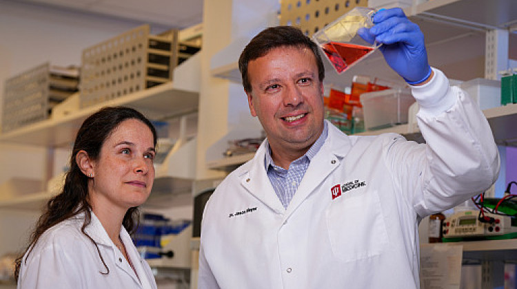 IU receives $16 million national grant to study Alzheimer’s using human brain models