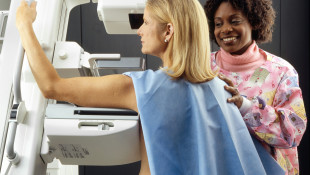 Women will now be informed of their breast density in mammogram reports. Here’s why that matters