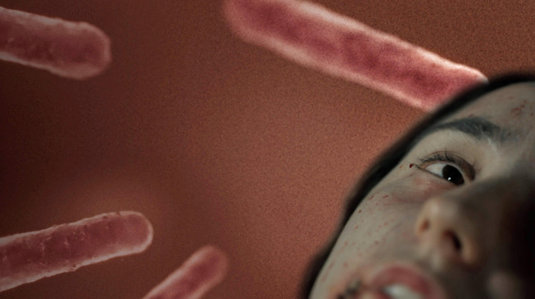 Chasing the Plague Chasing the Plague